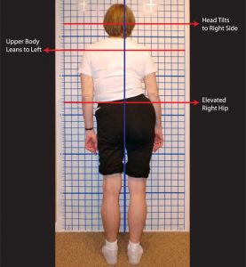 What Is Egoscue?  Posture Alignment Therapy - Oregon Exercise Therapy