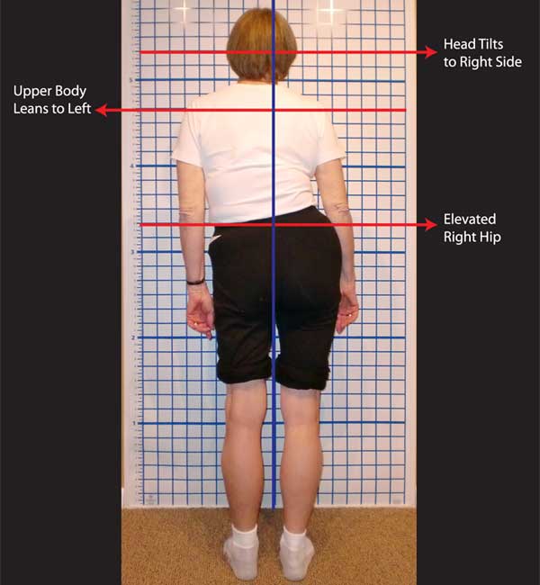 About Posture Alignment Therapy - Align Your Body